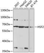 HSF2 Antibody in Western Blot (WB)