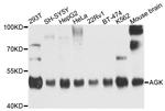 AGK Antibody in Western Blot (WB)