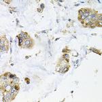 GALC Antibody in Immunohistochemistry (Paraffin) (IHC (P))