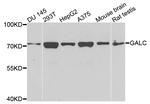 GALC Antibody in Western Blot (WB)