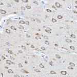 PTPN23 Antibody in Immunohistochemistry (Paraffin) (IHC (P))