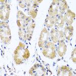 MRPL11 Antibody in Immunohistochemistry (Paraffin) (IHC (P))