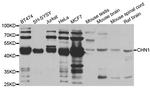 CHN1 Antibody in Western Blot (WB)