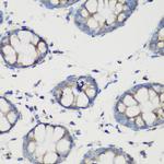 GluD1 Antibody in Immunohistochemistry (Paraffin) (IHC (P))