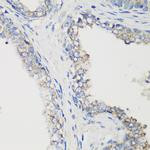 GluD1 Antibody in Immunohistochemistry (Paraffin) (IHC (P))