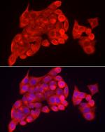 SKIP Antibody in Immunocytochemistry (ICC/IF)