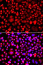 ALG1 Antibody in Immunocytochemistry (ICC/IF)