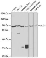 ALG1 Antibody in Western Blot (WB)