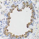 B9D1 Antibody in Immunohistochemistry (Paraffin) (IHC (P))