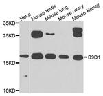 B9D1 Antibody in Western Blot (WB)