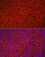 HSD3B1 Antibody in Immunocytochemistry (ICC/IF)