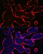 HSD3B1 Antibody in Immunocytochemistry (ICC/IF)