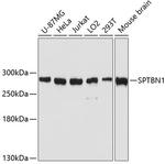 SPTBN1 Antibody in Western Blot (WB)