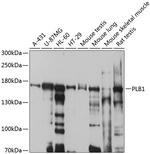 PLB1 Antibody in Western Blot (WB)