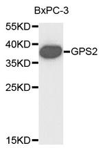 GPS2 Antibody in Western Blot (WB)