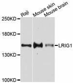 LRIG1 Antibody in Western Blot (WB)