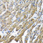 THUMPD3 Antibody in Immunohistochemistry (Paraffin) (IHC (P))