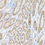 THUMPD3 Antibody in Immunohistochemistry (Paraffin) (IHC (P))