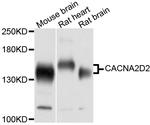 CACNA2D2 Antibody in Western Blot (WB)