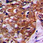 MVK Antibody in Immunohistochemistry (Paraffin) (IHC (P))