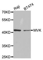 MVK Antibody in Western Blot (WB)