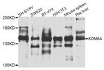 KDM6A Antibody in Western Blot (WB)