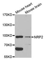 Neuropilin 2 Antibody in Western Blot (WB)