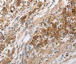 NPY1R Antibody in Immunohistochemistry (Paraffin) (IHC (P))