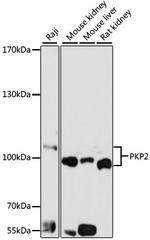 PKP2 Antibody in Western Blot (WB)