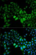 TK1 Antibody in Immunocytochemistry (ICC/IF)