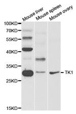 TK1 Antibody in Western Blot (WB)