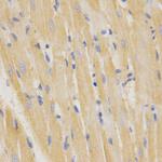 SFTPC Antibody in Immunohistochemistry (Paraffin) (IHC (P))