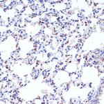 SFTPC Antibody in Immunohistochemistry (Paraffin) (IHC (P))