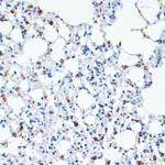 SFTPC Antibody in Immunohistochemistry (Paraffin) (IHC (P))