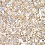 GLB1 Antibody in Immunohistochemistry (Paraffin) (IHC (P))