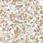 GLB1 Antibody in Immunohistochemistry (Paraffin) (IHC (P))