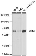 GLB1 Antibody in Western Blot (WB)