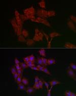 ANT Antibody in Immunocytochemistry (ICC/IF)