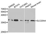 ANT Antibody in Western Blot (WB)