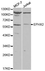 EPHX2 Antibody in Western Blot (WB)