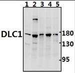 DLC1 Antibody in Western Blot (WB)