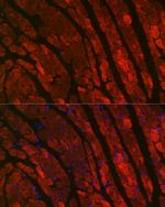 Cardiac Troponin C Antibody in Immunocytochemistry (ICC/IF)