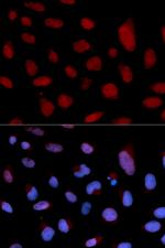 Cardiac Troponin C Antibody in Immunocytochemistry (ICC/IF)