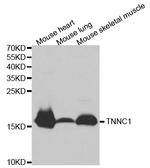 Cardiac Troponin C Antibody in Western Blot (WB)