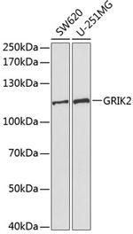 GluR6 Antibody in Western Blot (WB)