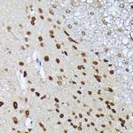 MT2A Antibody in Immunohistochemistry (Paraffin) (IHC (P))