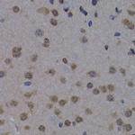 POLR2L Antibody in Immunohistochemistry (Paraffin) (IHC (P))