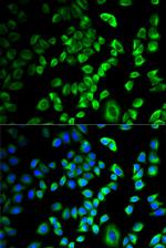 SERPINH1 Antibody in Immunocytochemistry (ICC/IF)