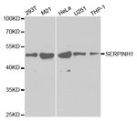 SERPINH1 Antibody in Western Blot (WB)