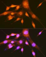 PCBP2 Antibody in Immunocytochemistry (ICC/IF)